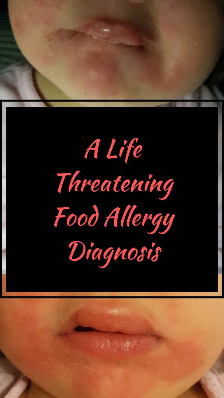 A Life Threatening Food Allergy Diagnosis - Traditional Home Living